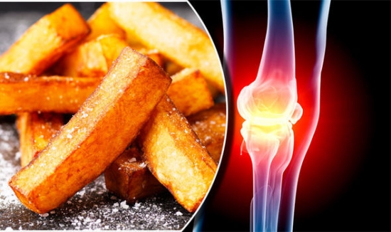 Arthritis symptoms: Should you stop eating potatoes?